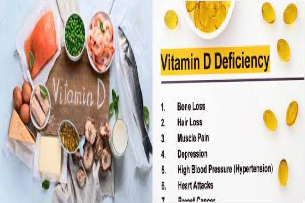 Vitamin D -Definition, Benefits, Causes, Symptoms of Vitamin D Deficiency